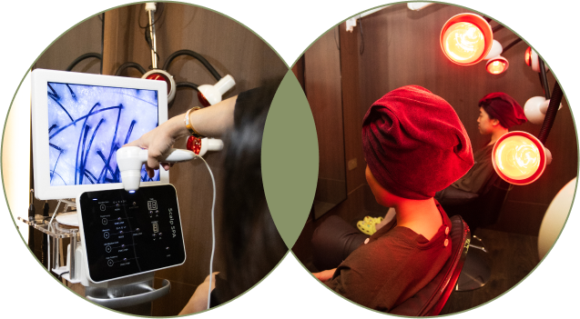 scalp_therapy