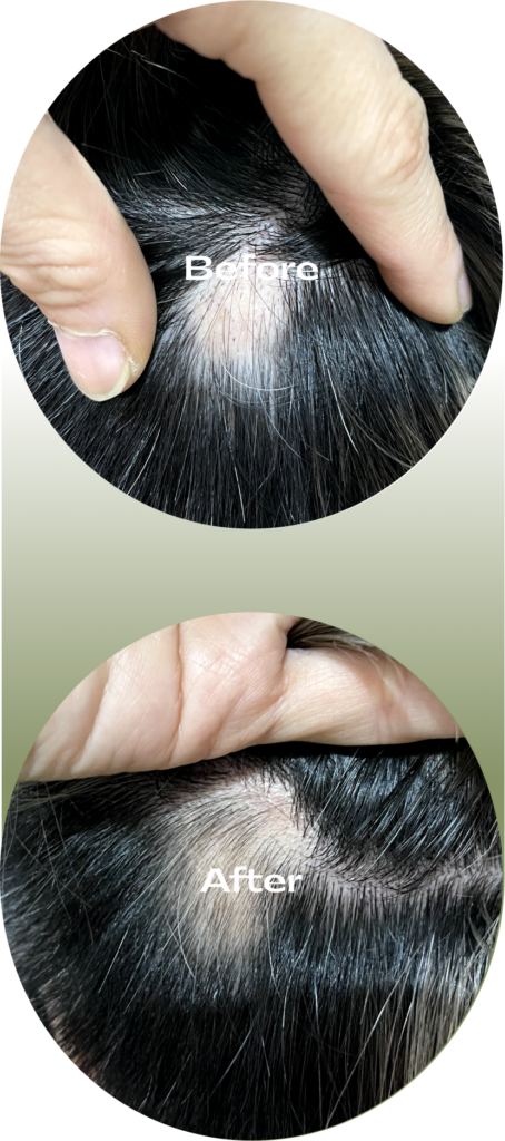 gary_before_after