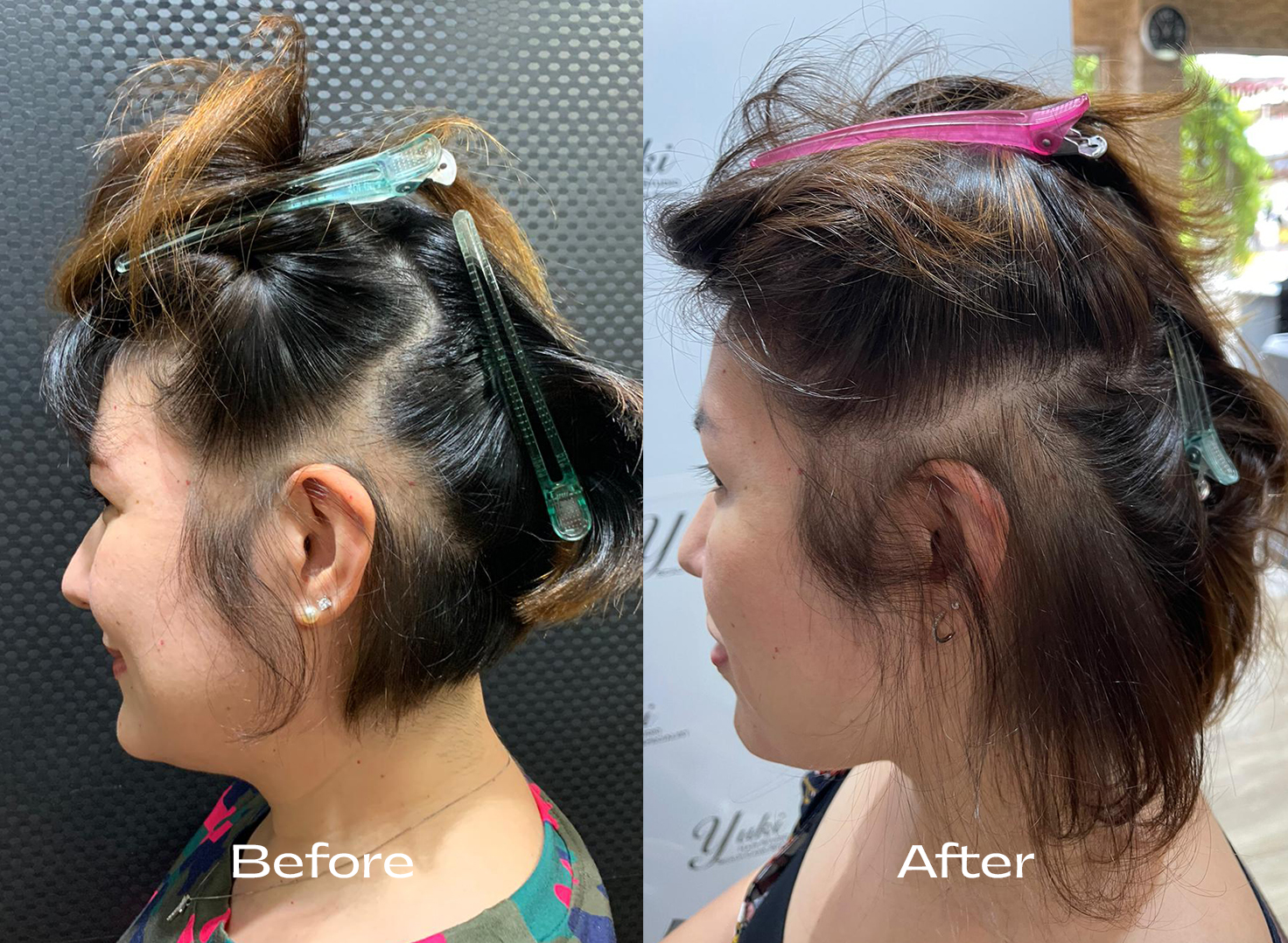 ruth_scalp_therapy